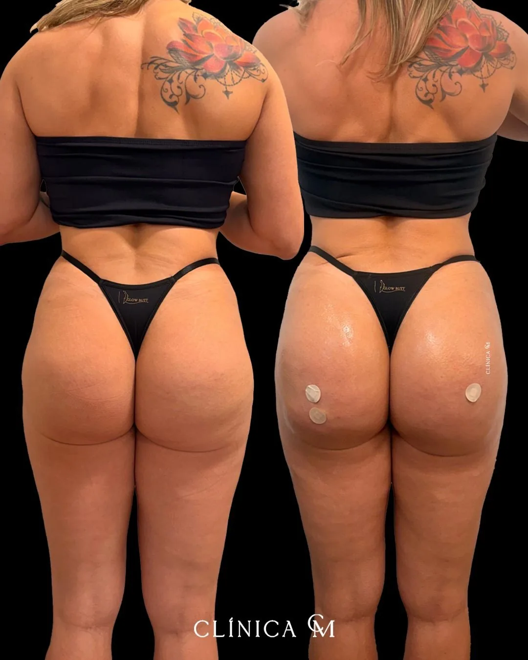 Resultado antes e depois 1